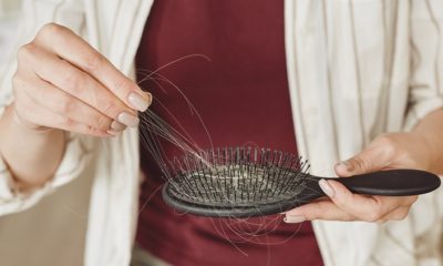does dandruff causes hair loss